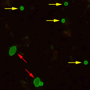 CryptoGiardiaDFA_400x2_arrows.jpg Figure D: <em>Cryptosporidium</em> sp. oocysts (yellow arrows) and cysts of Giardia duodenalis (red arrows) labeled with immunofluorescent antibodies.