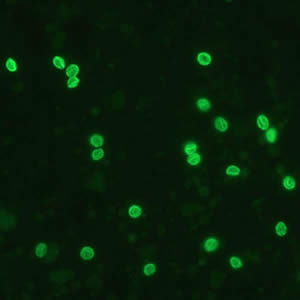 Cyrpto_fluor2_web.jpg Figure A: <em>Cryptosporidium</em> sp. oocysts labeled with immunofluorescent antibodies. Images contributed by the Kansas Department of Health and Environment.