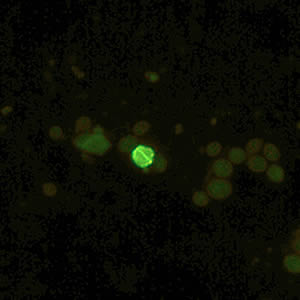 Cyrpto_fluor3_web.jpg Figure B: <em>Cryptosporidium</em> sp. oocyst labeled with immunofluorescent antibodies. Images contributed by the Kansas Department of Health and Environment.