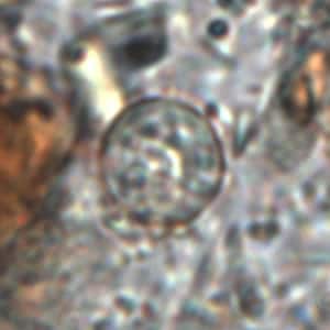 Figure B: Oocyst of <em>C. cayetanensis</em> in an unstained wet mount. Image courtesy of the Oregon State Public Health Laboratory.
