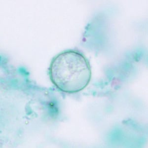 Micrograph showing circular oocysts of the parasite C. cayetanensis