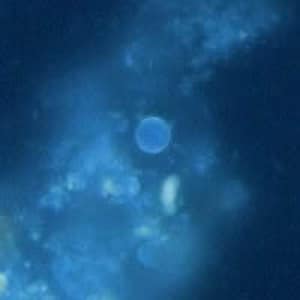 Figure A: Oocyst of <em>C. cayetanensis</em> viewed under UV microscopy.