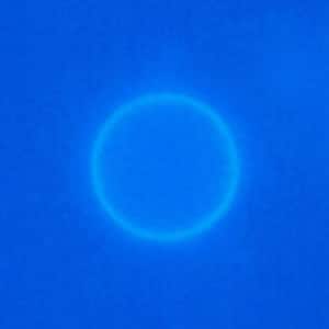 Figure C: Oocyst of <em>C. cayetanensis</em> viewed under UV microscopy.