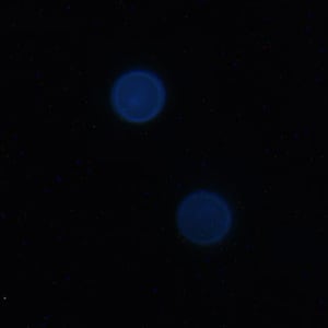 Figure E: Oocyst of <em>C. cayetanensis</em> viewed under UV microscopy.