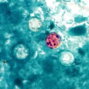 Figure A: Oocysts of <em>C. cayetanensis</em> stained with modified acid-fast stain. Note the variability of staining in the four oocysts.