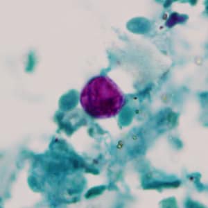 Figure D: Oocyst of <em>C. cayetanensis</em> stained with modified acid-fast stain.