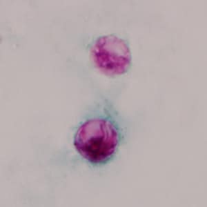 Figure E: Oocysts of <em>C. cayetanensis</em> stained with modified acid-fast stain.