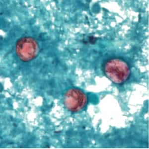 Figure C: Oocyst of <em>C. cayetanensis</em> stained with safranin (SAF).