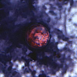 Figure D: Oocyst of <em>C. cayetanensis</em> stained with safranin (SAF).