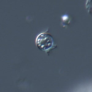 Figure B: Oocyst of <em>C. cayetanensis</em> viewed under differential interference contrast (DIC) microscopy. The refractile globules are easily visible under DIC.