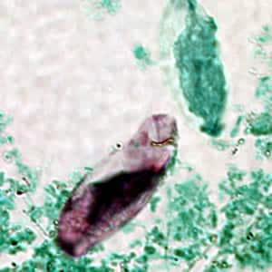 Figure C: Immature oocyst of <em>C. belli</em> stained with acid-fast, showing a single sporoblast.