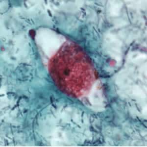 Figure B: Immature oocyst of <em>C. belli</em> stained with safranin, containing a single sporoblast.