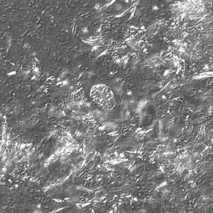 Figure C: Same oocyst as in  Figure A but viewed under differential interference contrast (DIC). 