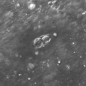 Figure D: Same oocyst as in Figure B but viewed under ultraviolet (UV) fluorescent micrscopy.