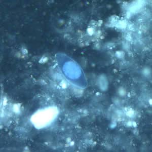 Figure E: Same oocyst as in Figures A and C but viewed under ultraviolet (UV) fluorescent micrscopy. 