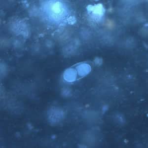 Figure F: Same oocyst as in Figures B and D but viewed under UV microscopy. 