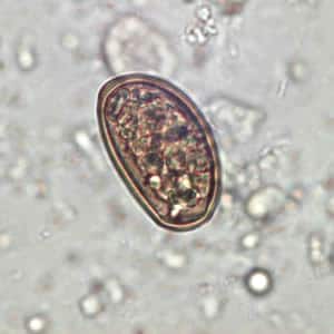D_dendriticum_egg_wtmt_JCG_C.jpg Figure B: Egg of <em>Dicrocoelium dendriticum</em> in an unstained wet mount of stool. Image courtesy of Dr. Juan Cuadros González.