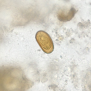 Dicrocoelium_HB2.jpg Figure D: Egg of <em>D. dendriticum</em> in an unstained wet mount of stool.