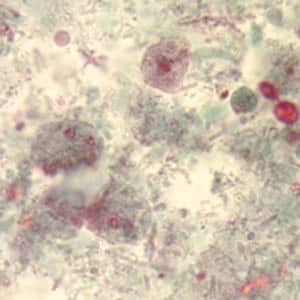 Figure D: Binucleate and uninucleate forms of trophozoites of <em>D. fragilis</em>, stained with trichrome.