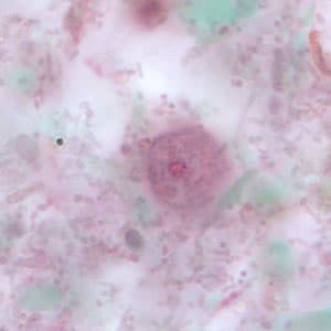 Figure C: Uninucleate form of a trophozoite of <em>D. fragilis</em>, stained with trichrome.
