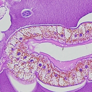 Dioctophyme_LTU_C.jpg Figure C: Higher-magnification of the specimens shown in Figures A and B, showing a close-up of the characteristic intestine, with cuboidal, uninucleate cells, pigment, and microvilli.