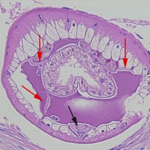 Dioctophyme_LTU_E.jpg Figure E: Higher-magnification of the specimens shown in Figures A-D. Shown in this image are the tall, polymyarian muscle cells, the characteristic ventral chord with a U-shaped row of nuclei (black arrow), and three pseudocoelomic membranes (red arrows).