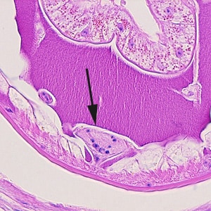Dioctophyme_LTU_F.jpg Figure F: Close-up of Figure A, showing the ventral chord (black-arrow).