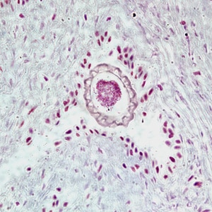D_renale_egg_tissue1.jpg Figure A: Egg of <em>D. renale</em> in the kidney of a mink, stained with hematoxylin and eosin (H&E).