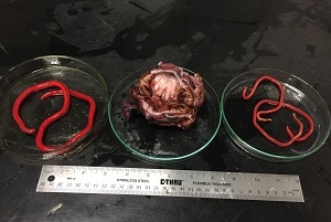 D_re_both Figure A: One <em>D. renale</em> female (left) and two males (right) extracted from the kidney of a naturally infected dog.