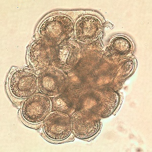 D_caninium_dehazed_A Figure B: <em>D. caninum</em> egg packet in a wet mount.