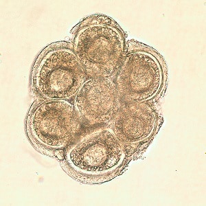 D_caninium_dehazed_B Figure C: <em>D. caninum</em> egg packet in wet mount.