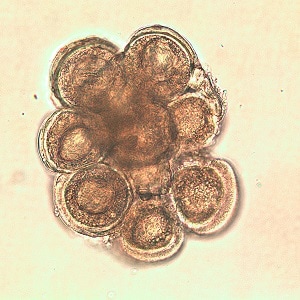 D_caninium_dehazed_C Figure D: <em>D. caninum</em> egg packet in wet mount.