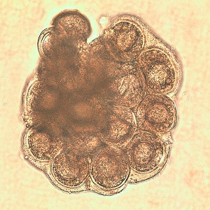 D_caninium_dehazed_D Figure E: <em>D. caninum</em> egg packet in wet mount.