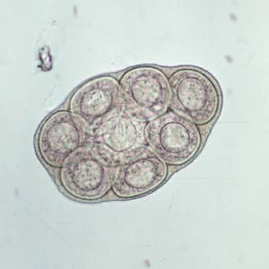 Dcaninum_eggpk_wtmt.jpg Figure A: <em>D. caninum</em> egg packet, containing 8 visible eggs, in a wet mount.