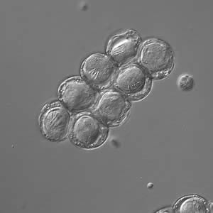 Dcaninum_eggpk_DIC.jpg Figure C: <em>D. caninum</em> eggs clumped together under differential interference contrast microscopy (same eggs as in Image B).