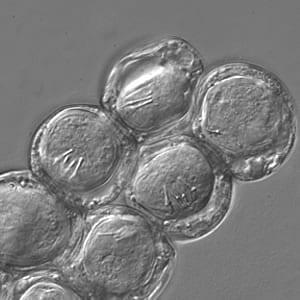 Dcaninum_eggpk_DIC_crop.jpg Figure D: Close up of Image C. Note the visible hooklets in three of the eggs.