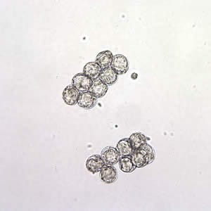 Dcaninum_eggpk_wtmt6.jpg Figure A: <em>D. caninum</em> eggs clumped together in a wet mount. Image taken at 200x magnification.