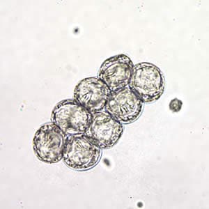 Dcaninum_eggpk_wtmt_hook.jpg Figure B: <em>D. caninum</em> eggs clumped together in a wet mount. Image taken at 400x magnification, hooklets in the some of the eggs are visible.