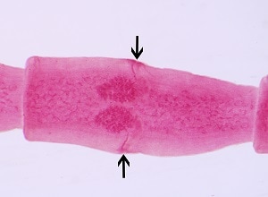 D_caninum_carmine_A Figure D: <em>D. caninum</em> proglottid. The genital pores are clearly visible in the carmine-stained proglottid.