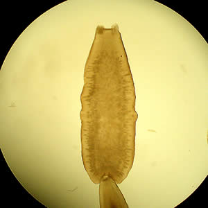 Dcaninum_proglottid.jpg Figure A: <em>D. caninum</em> proglottid under a dissecting microscope cleared with lactophenol.