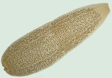 Dcaninum_proglottid2.jpg Figure B: <em>D. caninum</em> proglottid.