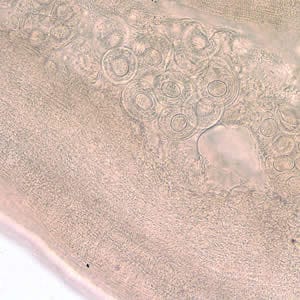 Dcaninum_proglottid3.jpg Figure C: <em>D. caninum</em> proglottid partially cleared with lactophenol, showing eggs and egg packets.