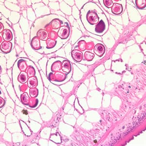 Dcaninum_proglottid_he2.jpg Figure B: Cross-section of a <em>D. caninum</em> proglottid stained with H&E. Image taken at 200x magnfication.