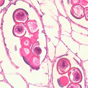 Dcaninum_proglottid_he3.jpg Figure C: Cross-section of a <em>D. caninum</em> proglottid stained with H&E. Image taken at 400x magnification