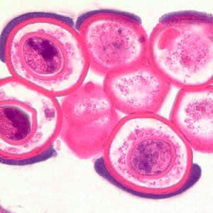 Dcaninum_proglottid_he4.jpg Figure D: Cross-section of a <em>D. caninum</em> proglottid stained with H&E. Image taken at 1000x magnification.