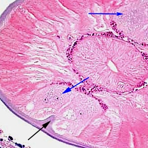 Dirofilaria_DerksA.jpg Figure D: The same specimen as Figure C, at 400x magnification. Note the presence of lateral chords (blue arrows) and internal lateral ridge (black arrow).