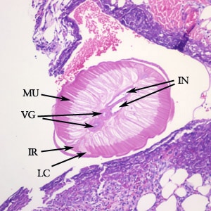 Dirofilaria_PA2_answer.jpg Figure A: Cross-section of <em>Dirofilaria</em> sp. from a subcutaneous nodule, stained with hematoxylin and eosin (H&E). Morphologic features visible in this image include tall, prominent muscle cells (MU), coiled vagina (VG), coiled intestine (IN), lateral chords (LC), and prominent internal lateral ridges (IR). Image courtesy of Drs. Dirk Elston and Paul Bourbeau.
