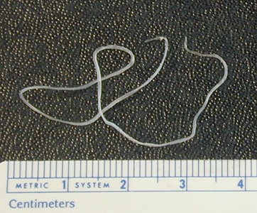Dirofilaria_eye_BAM1.jpg Figure E: <em>Dirofilaria</em> sp. (suspect D. tenuis) removed from the eye of a patient.
