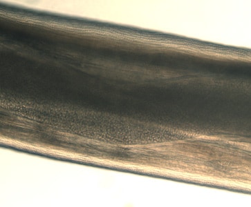 Dirofilaria_eye_BAM4.jpg Figure F: Close-up of the specimen in Figure E showing the cuticular ridging. A uterine tube can also be seen through the cuticle.