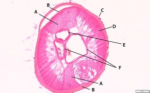 SQ_Dt_B Figure B: Another section of <em>Dirofilaria tenuis</em> from a subcutaneous nodule. Many useful dirofilarine features are visible: large lateral chords (A); internal lateral ridge at the level of the lateral chords (B); multi-layered ridged cuticle (C); tall, coelomyrian musculature (D); small intestine (E); and paired reproductive tubules (F).
